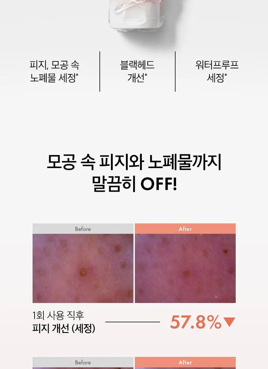 [피지 흡착/젤to오일] 닥터슈라클 오알파 멜팅 클렌징 젤 150ml 상세페이지 12